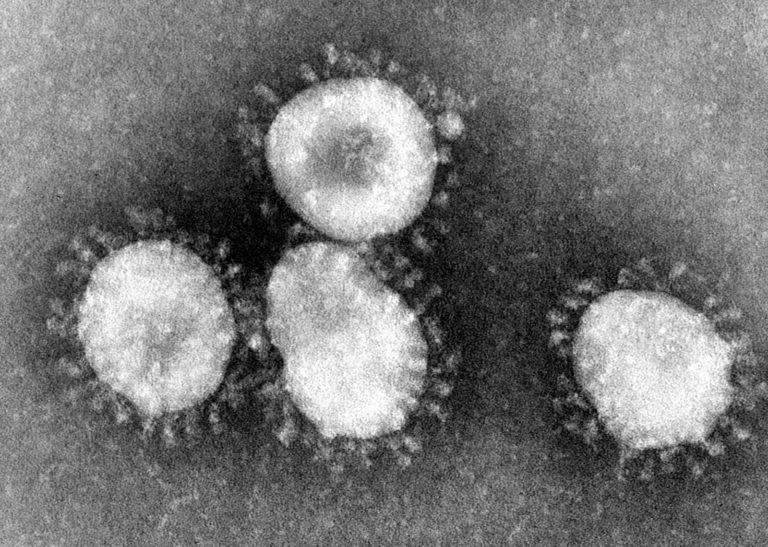 Coronavirus: agenzie alimentari ONU offrono supporto alla Cina, partecipano anche OMS eAIEA